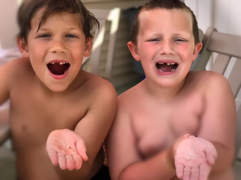 Cousins lose same tooth minutes apart!!